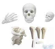 TCT亞洲展:3D打印在骨板設計中的應用